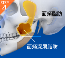 美人在骨也在皮！View韩国面部轮廓手术不止削骨，还有……