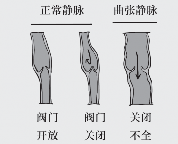 济南静脉曲张医院收费平价吗 打造智慧健康医疗服务